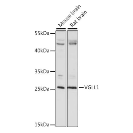 Western Blot - Anti-TDU Antibody (A89124) - Antibodies.com