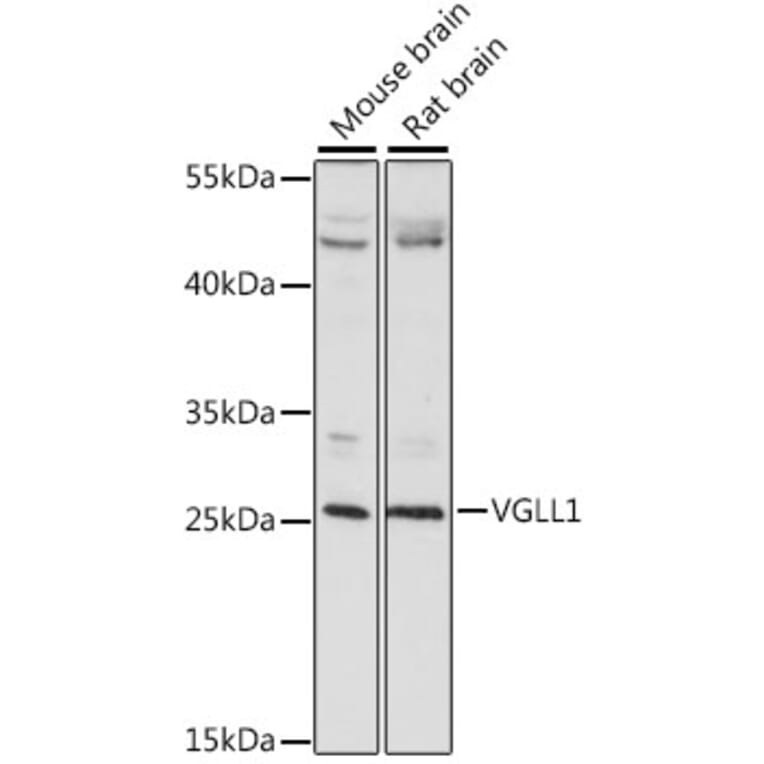 Western Blot - Anti-TDU Antibody (A89124) - Antibodies.com