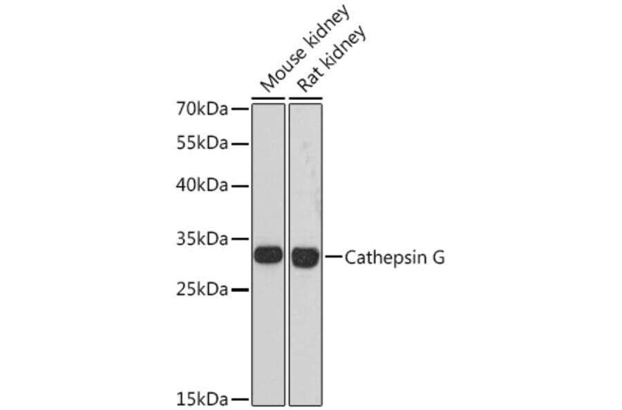 Western Blot - Anti-Cathepsin G Antibody (A89125) - Antibodies.com