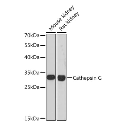 Western Blot - Anti-Cathepsin G Antibody (A89125) - Antibodies.com