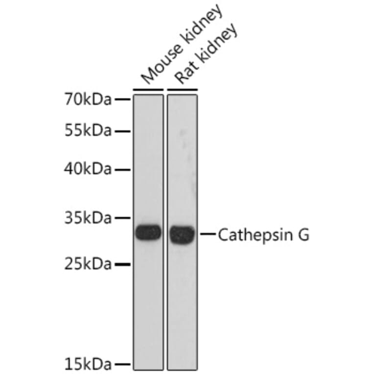 Western Blot - Anti-Cathepsin G Antibody (A89125) - Antibodies.com