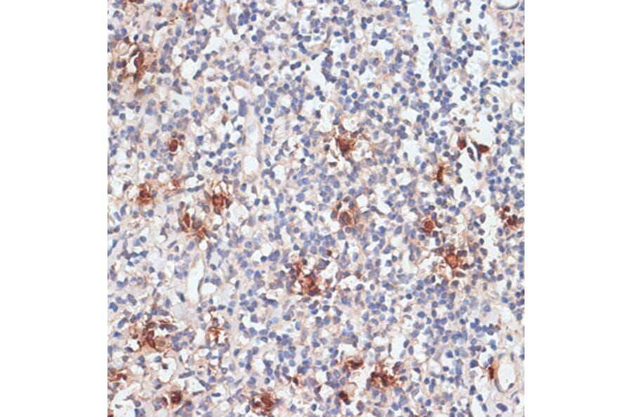 Immunohistochemistry - Anti-Cathepsin G Antibody (A89125) - Antibodies.com