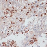 Immunohistochemistry - Anti-Cathepsin G Antibody (A89125) - Antibodies.com