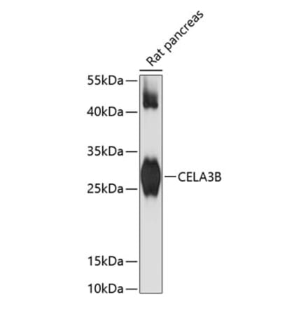 Western Blot - Anti-Elastase Antibody (A89126) - Antibodies.com