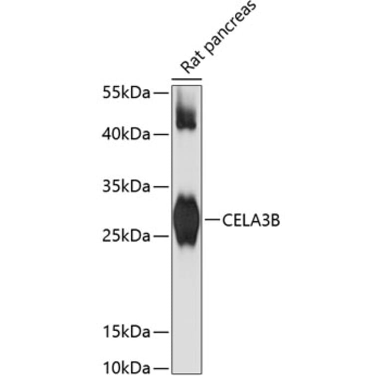 Western Blot - Anti-Elastase Antibody (A89126) - Antibodies.com