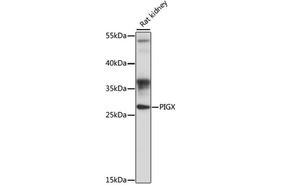 Western Blot - Anti-PIGX Antibody (A89127) - Antibodies.com