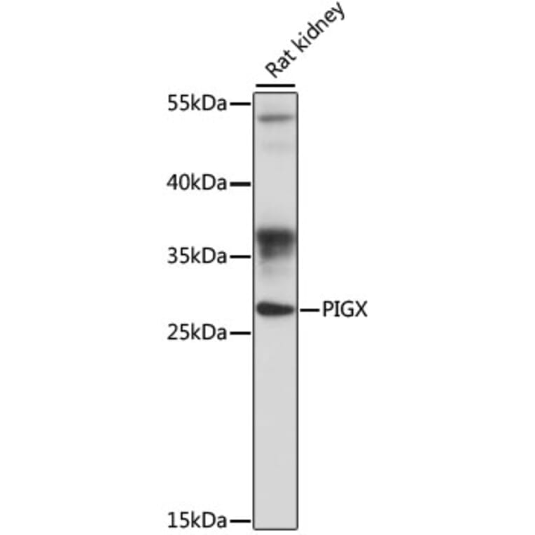 Western Blot - Anti-PIGX Antibody (A89127) - Antibodies.com