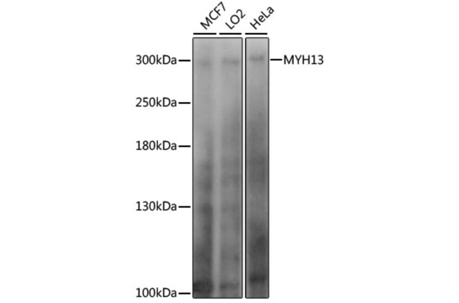 Western Blot - Anti-Myosin 13 Antibody (A89128) - Antibodies.com