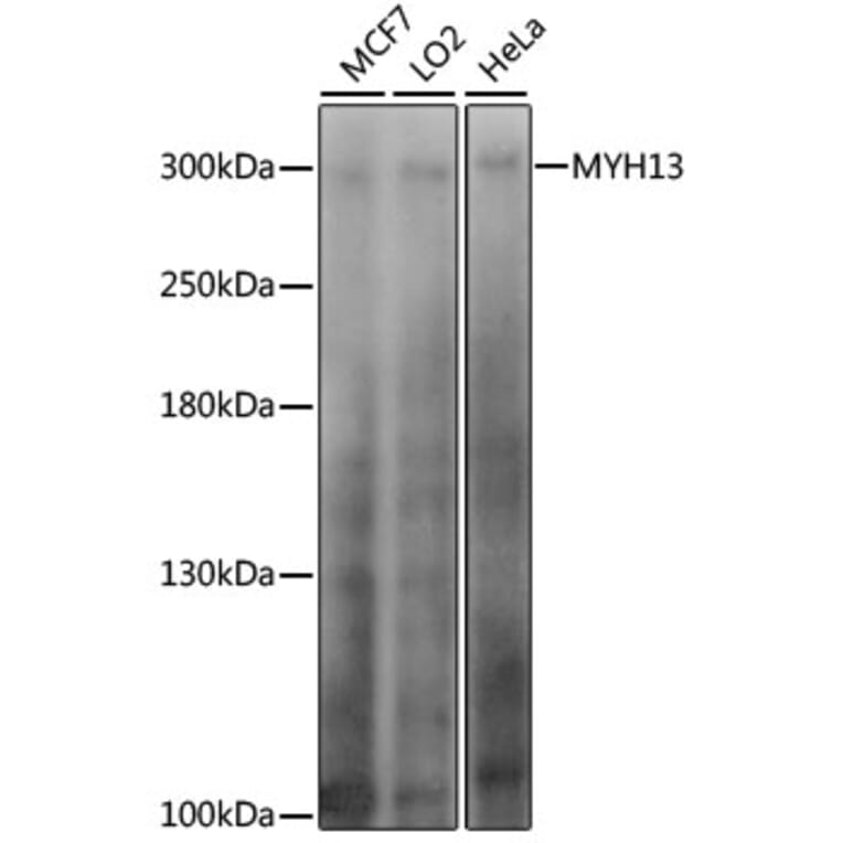 Western Blot - Anti-Myosin 13 Antibody (A89128) - Antibodies.com