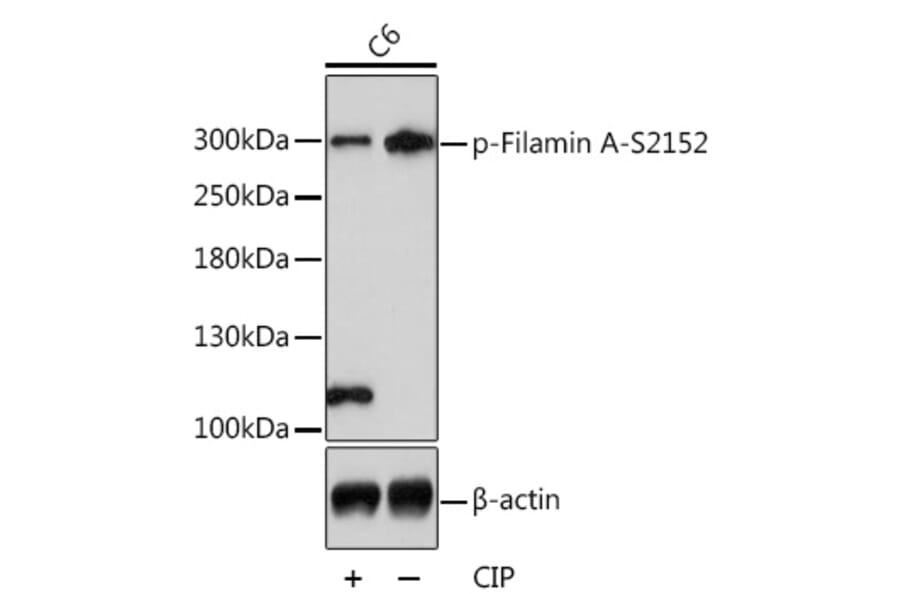 Western Blot - Anti-Filamin A (phospho Ser2152) Antibody (A89129) - Antibodies.com