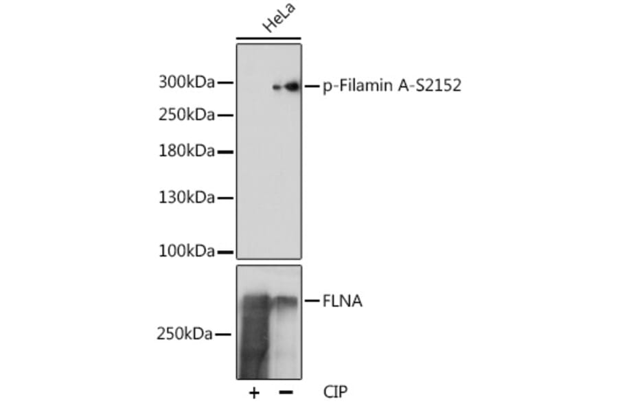 Western Blot - Anti-Filamin A (phospho Ser2152) Antibody (A89129) - Antibodies.com
