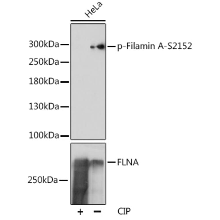 Western Blot - Anti-Filamin A (phospho Ser2152) Antibody (A89129) - Antibodies.com