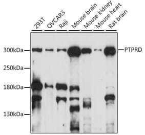 Western Blot - Anti-PTPRD Antibody (A89130) - Antibodies.com