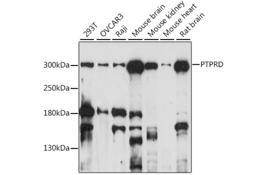 Western Blot - Anti-PTPRD Antibody (A89130) - Antibodies.com