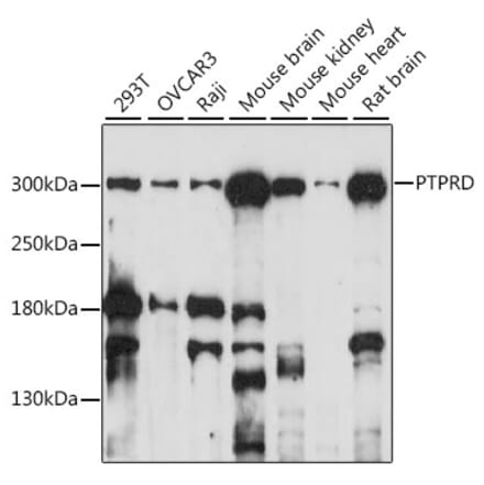 Western Blot - Anti-PTPRD Antibody (A89130) - Antibodies.com