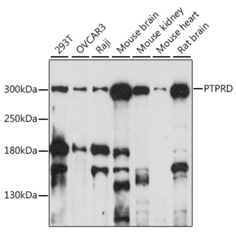Western Blot - Anti-PTPRD Antibody (A89130) - Antibodies.com