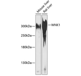 Western Blot - Anti-WNK1 Antibody (A89131) - Antibodies.com