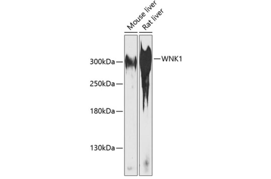 Western Blot - Anti-WNK1 Antibody (A89131) - Antibodies.com