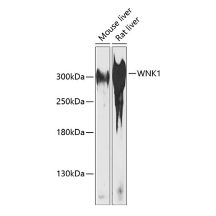 Western Blot - Anti-WNK1 Antibody (A89131) - Antibodies.com