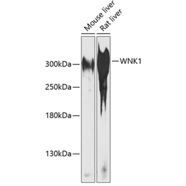 Western Blot - Anti-WNK1 Antibody (A89131) - Antibodies.com