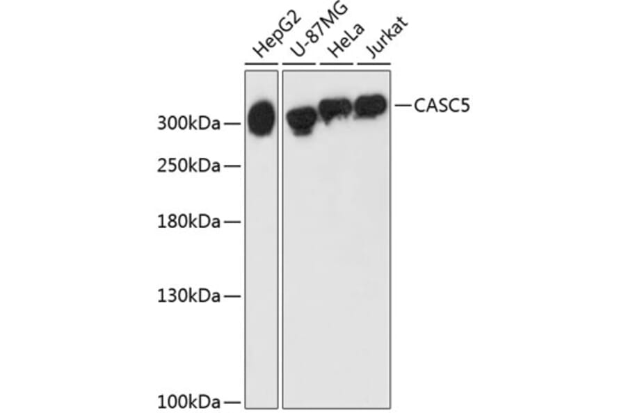 Western Blot - Anti-CASC5/KNL1 Antibody (A89132) - Antibodies.com