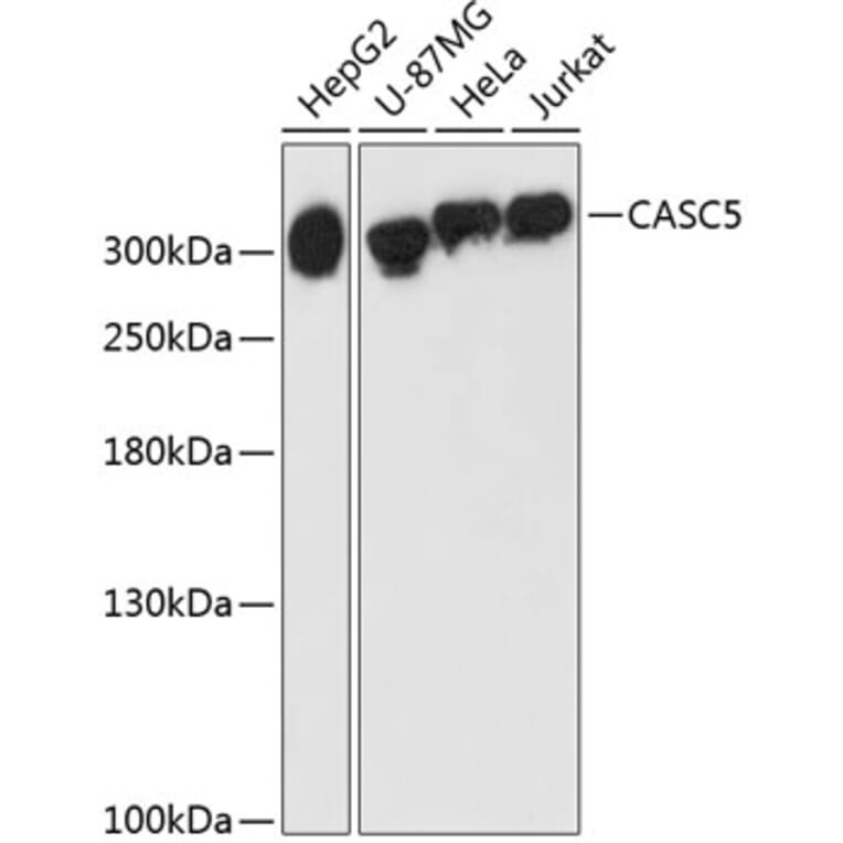 Western Blot - Anti-CASC5/KNL1 Antibody (A89132) - Antibodies.com
