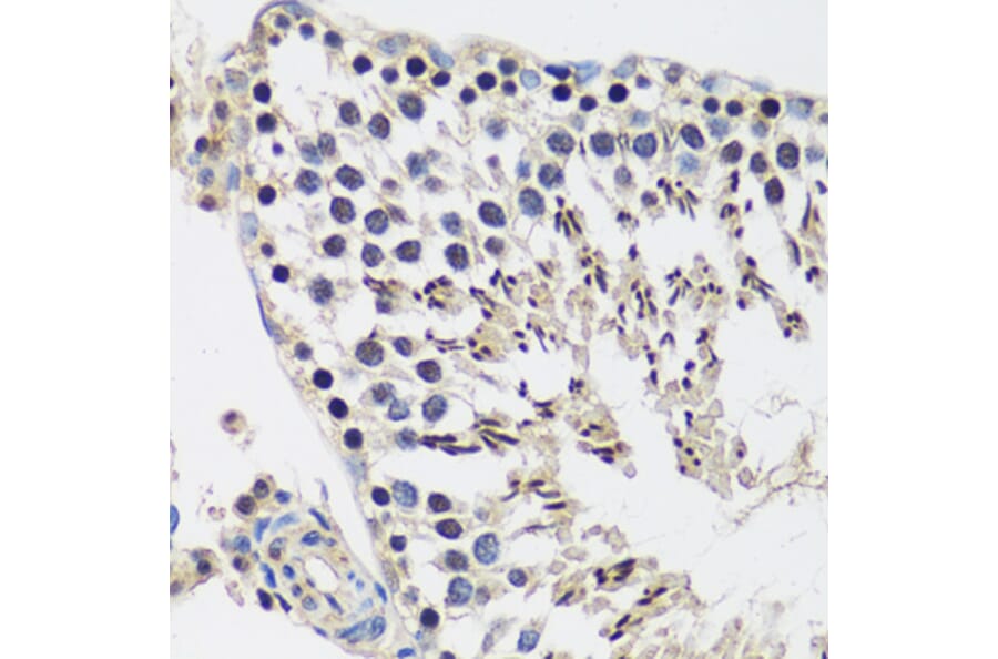 Immunohistochemistry - Anti-CASC5/KNL1 Antibody (A89132) - Antibodies.com