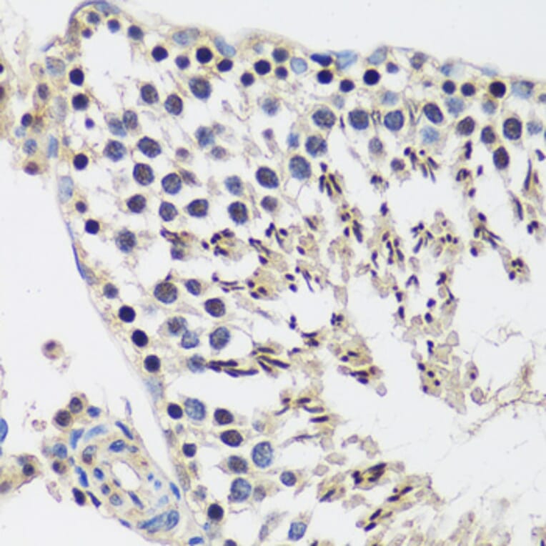 Immunohistochemistry - Anti-CASC5/KNL1 Antibody (A89132) - Antibodies.com