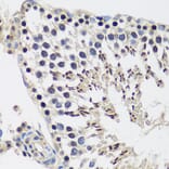 Immunohistochemistry - Anti-CASC5/KNL1 Antibody (A89132) - Antibodies.com