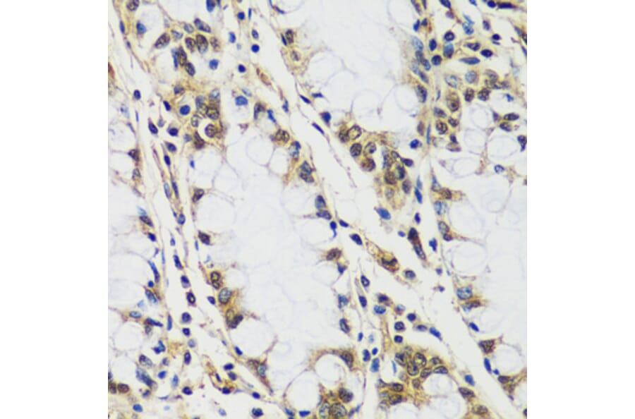 Immunohistochemistry - Anti-CASC5/KNL1 Antibody (A89132) - Antibodies.com
