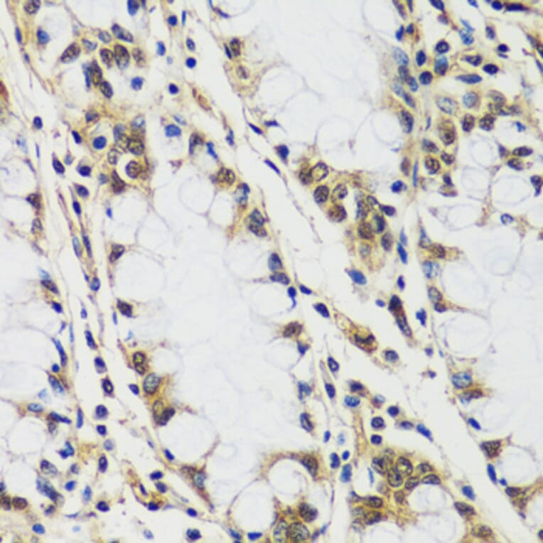 Immunohistochemistry - Anti-CASC5/KNL1 Antibody (A89132) - Antibodies.com