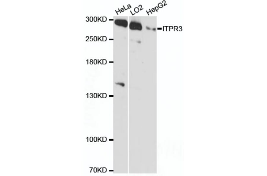 Western Blot - Anti-ITPR3 Antibody (A89133) - Antibodies.com