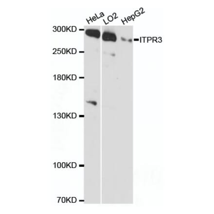 Western Blot - Anti-ITPR3 Antibody (A89133) - Antibodies.com