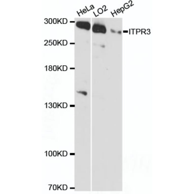 Western Blot - Anti-ITPR3 Antibody (A89133) - Antibodies.com