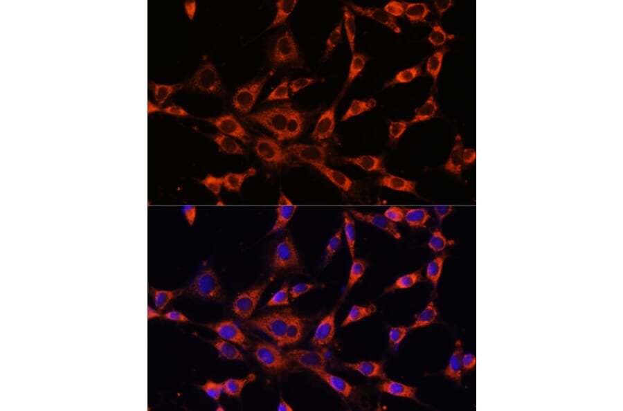 Immunofluorescence - Anti-ITPR3 Antibody (A89133) - Antibodies.com