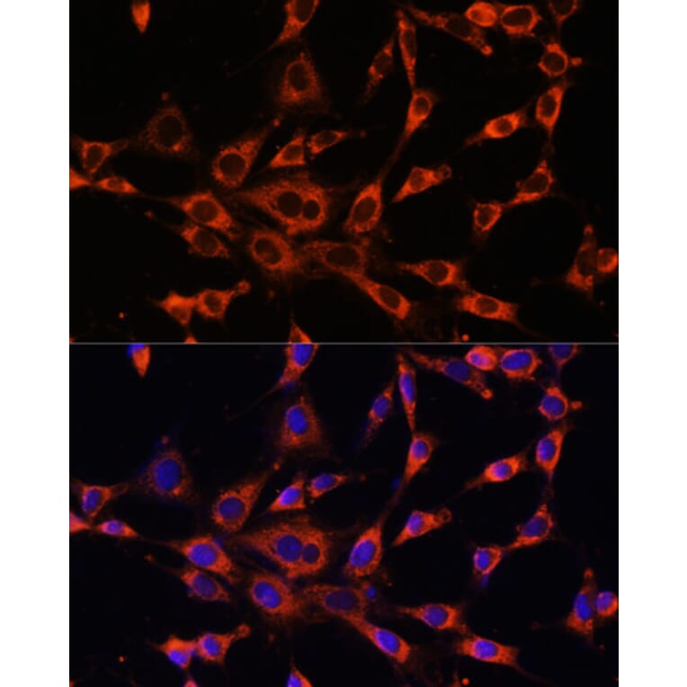 Immunofluorescence - Anti-ITPR3 Antibody (A89133) - Antibodies.com