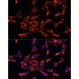 Immunofluorescence - Anti-ITPR3 Antibody (A89133) - Antibodies.com