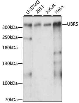 Western blot analysis of extracts of various cell lines, using Anti-UBR5 Antibody (A13816) at 1:3000 dilution.
Secondary antibody: Goat Anti-Rabbit IgG (H+L) (HRP) (AS014) at 1:10,000 dilution.
Lysates / proteins: 25µg per lane.
Blocking buffer: 3% non-fat dry milk in TBST.
Detection: ECL Enhanced Kit (RM00021).
Exposure time: 60s.