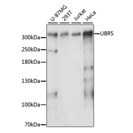 Western Blot - Anti-EDD Antibody (A89135) - Antibodies.com