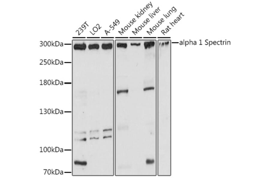 Western Blot - Anti-alpha 1 Spectrin Antibody (A89136) - Antibodies.com