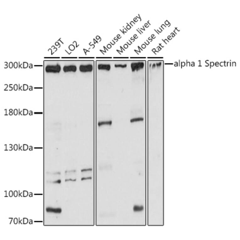 Western Blot - Anti-alpha 1 Spectrin Antibody (A89136) - Antibodies.com
