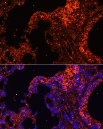 Anti-alpha 1 Spectrin Antibody (A89136) | Antibodies.com