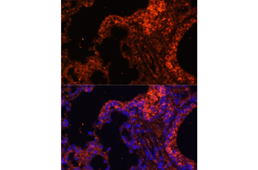 Immunofluorescence - Anti-alpha 1 Spectrin Antibody (A89136) - Antibodies.com