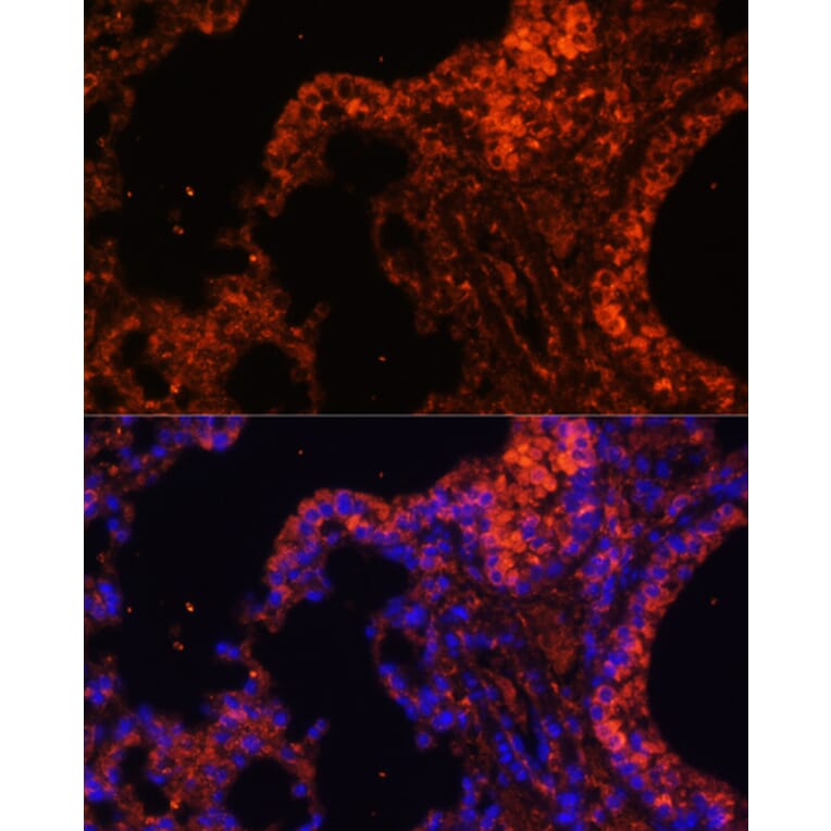 Immunofluorescence - Anti-alpha 1 Spectrin Antibody (A89136) - Antibodies.com