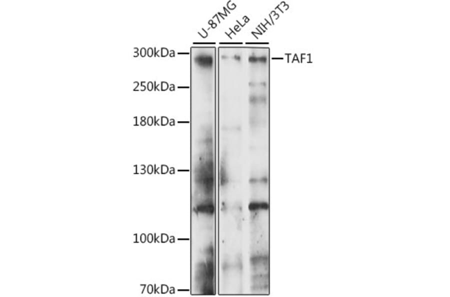 Western Blot - Anti-KAT4/TBP Associated Factor 1 Antibody (A89137) - Antibodies.com