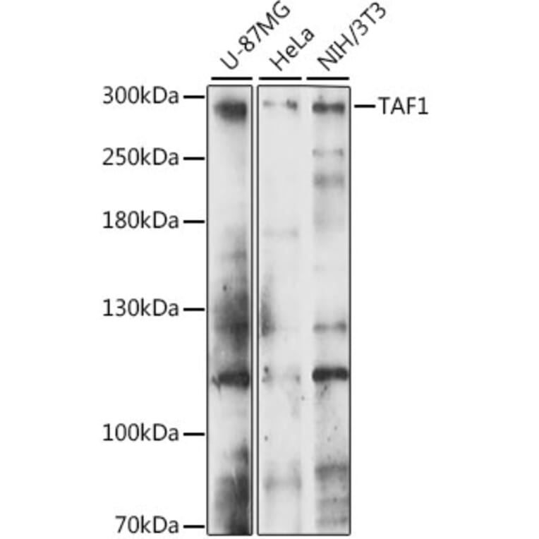Western Blot - Anti-KAT4/TBP Associated Factor 1 Antibody (A89137) - Antibodies.com