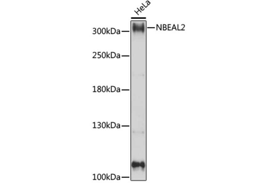 Western Blot - Anti-NBEAL2 Antibody (A89138) - Antibodies.com