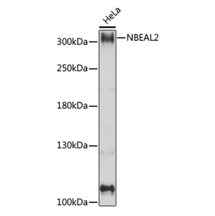 Western Blot - Anti-NBEAL2 Antibody (A89138) - Antibodies.com