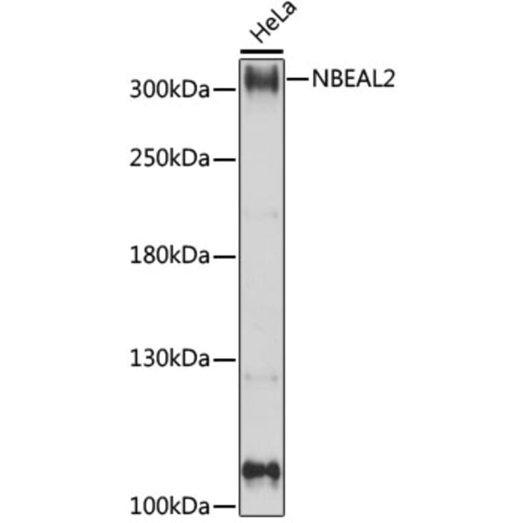 Western Blot - Anti-NBEAL2 Antibody (A89138) - Antibodies.com