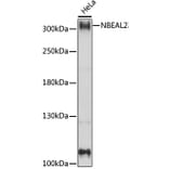 Western Blot - Anti-NBEAL2 Antibody (A89138) - Antibodies.com